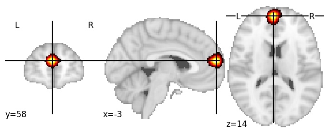 Component 1004: Dorsomedial prefrontal cortex anterior LH