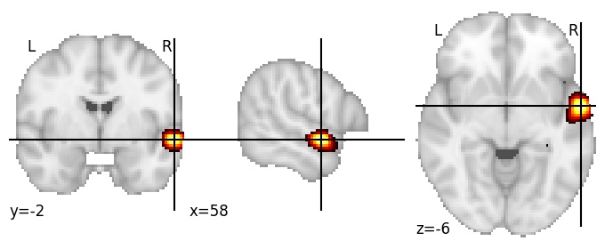 Component 1019: Superior temporal gyrus anterior RH