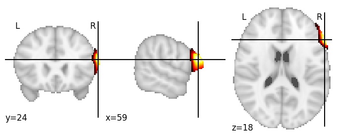 Component 118: Inferior frontal gyrus posterior RH