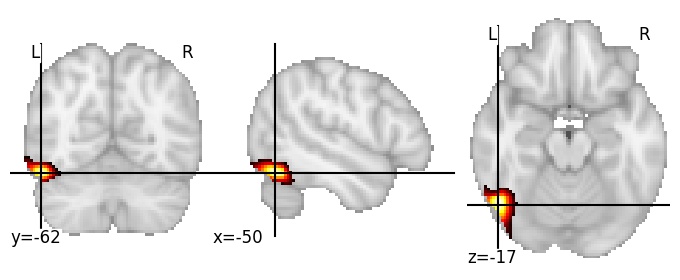 Component 122: Inferior occipital gyrus anterior LH