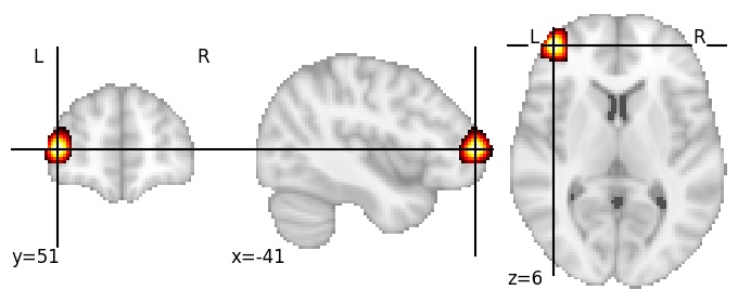 Component 126: Ventrolateral prefrontal cortex LH