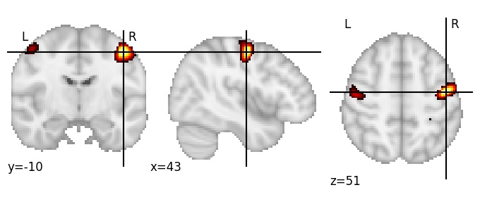 Component 14: Precentral gyrus middle