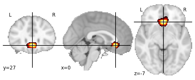 Component 134: Subgenual cortex