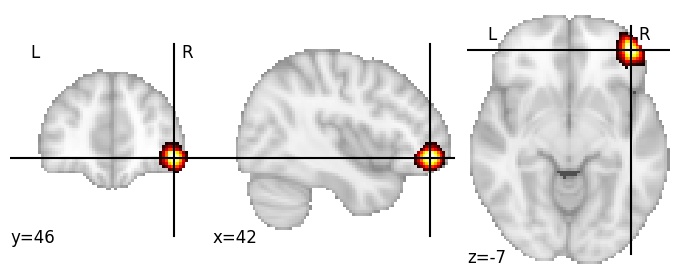 Component 135: Inferior frontal gyrus anterior RH