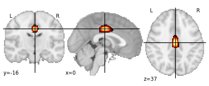 Component 161: Cingulate cortex mid-posterior