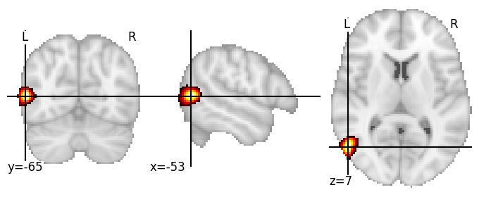 Component 173: Lateral occipital cortex anterior LH