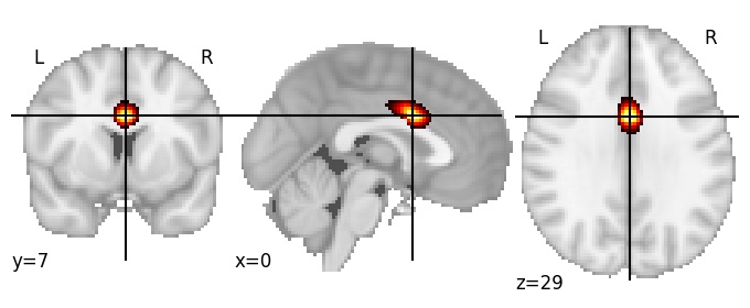 Component 204: Cingulate cortex mid-anterior