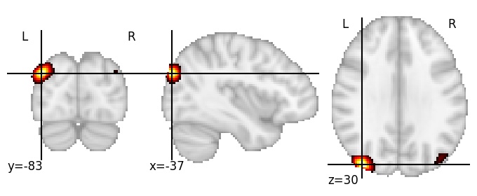 Component 224: Superior occipital gyrus LH