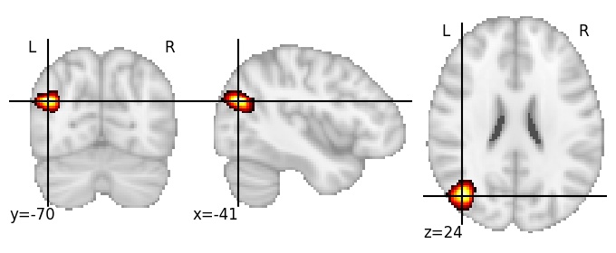 Component 226: Lateral occipital cortex superior LH