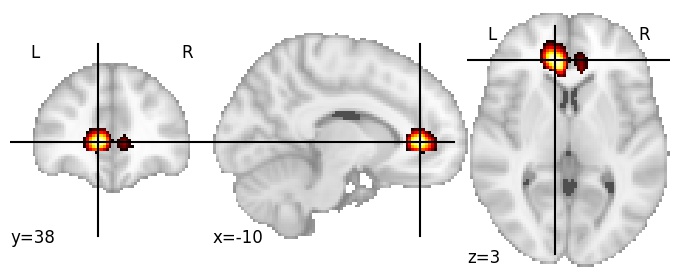 Component 235: Anterior cingulate cortex inferior LH