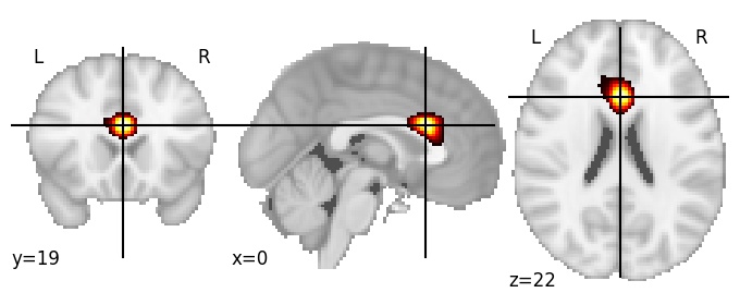 Component 264: Anterior cingulate cortex superior