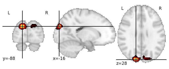 Component 288: Descending occipital gyrus superior
