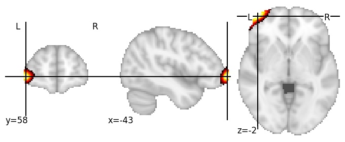 Component 293: Lateral orbital cortex LH