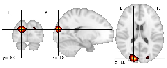 Component 297: Descending occipital gyrus superior LH