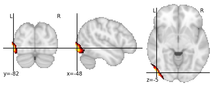 Component 307: Lateral occipital cortex inferior LH