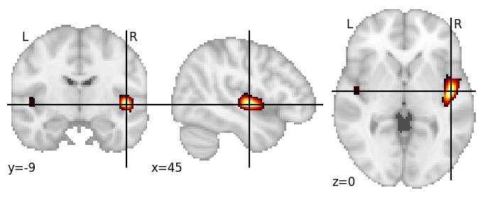 Component 308: Heschl’s gyrus anterior medial RH