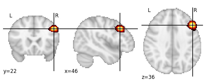 Component 32: Middle frontal gyrus mid-posterior inferior RH