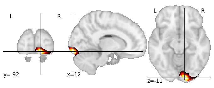 Component 342: Occipital pole inferior medial RH