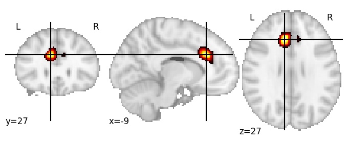 Component 36: Cingulate cortex mid-anterior LH