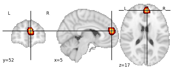 Component 367: Dorsomedial prefrontal cortex anterior RH