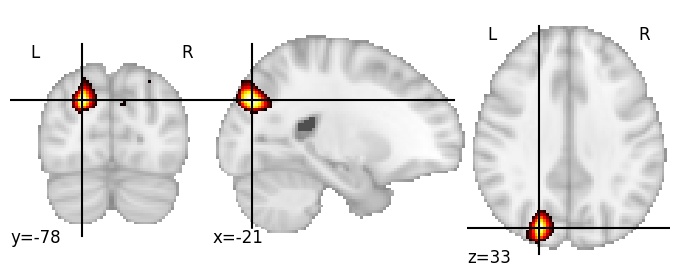 Component 368: Superior occipital gyrus superior LH