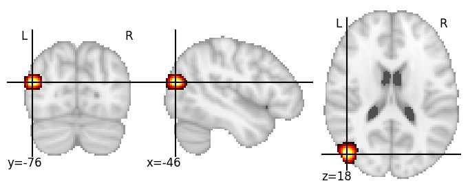 Component 373: Lateral occipital cortex postero-superior LH
