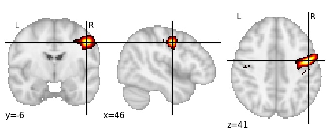 Component 376: Precentral gyrus mid-inferior RH