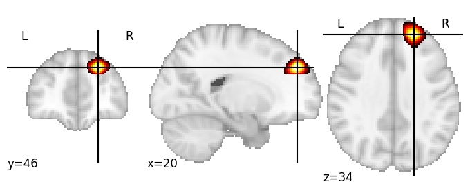 Component 389: Superior frontal gyrus anterior RH