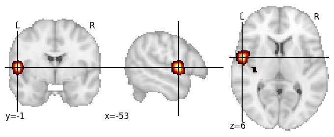 Component 41: Central opercular cortex LH