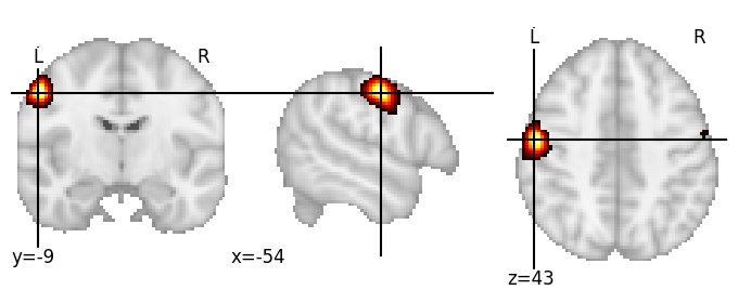 Component 436: Precentral gyrus middle posterior LH