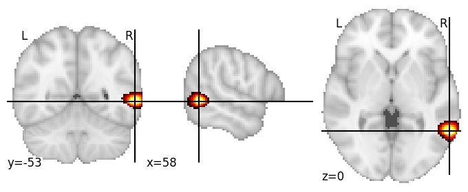 Component 437: Middle temporal gyrus postero-inferior RH