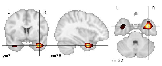 Component 460: Inferior temporal gyrus anterior RH
