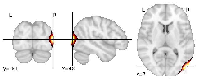 Component 468: Lateral occipital cortex postero-inferior RH