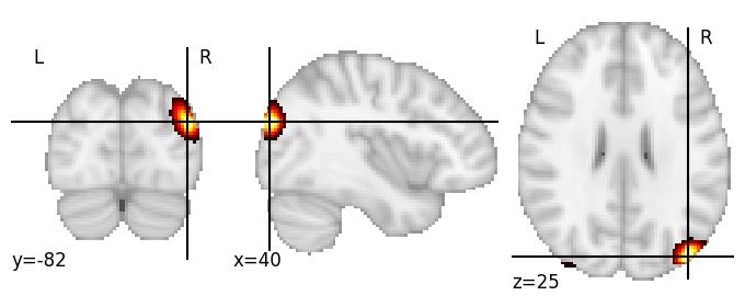 Component 473: Lateral occipital cortex posterior RH