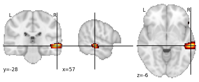 Component 474: Middle temporal gyrus middle RH