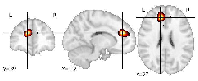 Component 475: Paracingulate gyrus mid-anterior LH