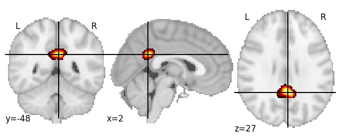 Component 493: Posterior cingulate cortex