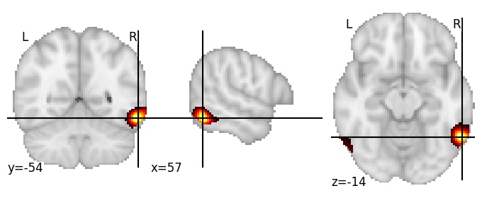 Component 499: Inferior temporal gyrus posterior RH
