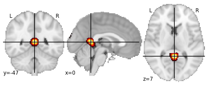 Component 529: Retrosplenial cortex posterior