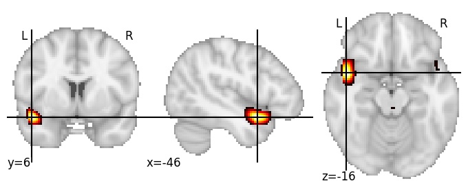 Component 543: Superior temporal gyrus anterior LH