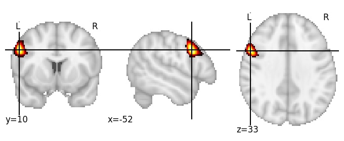 Component 566: Middle frontal gyrus posterior LH