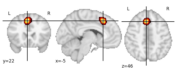 Component 572: Paracingulate gyrus mid-posterior LH