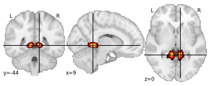 Component 583: Posterior cingulate cortex inferior