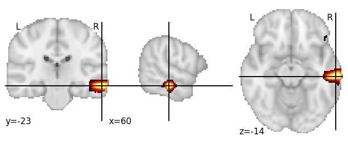 Component 584: Middle temporal gyrus mid-anterior RH