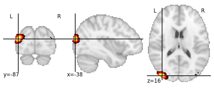Component 608: Lateral occipital cortex posterior LH