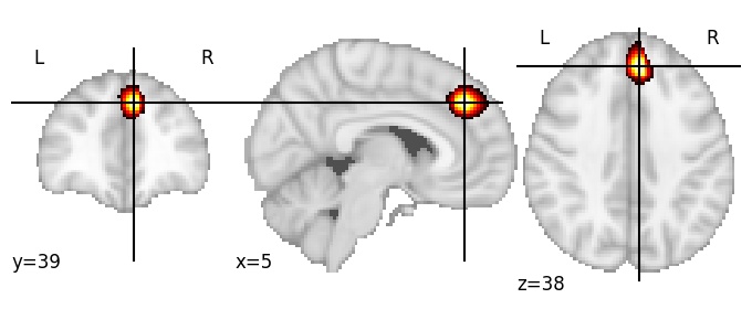 Component 645: Dorsomedial prefrontal cortex superior RH
