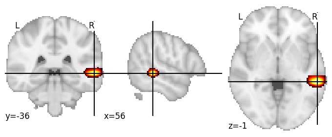 Component 654: Middle temporal gyrus mid-posterior RH