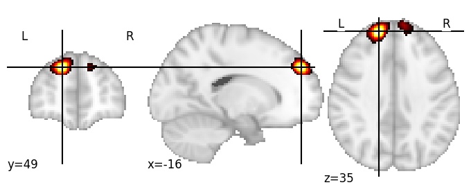 Component 675: Dorsolateral prefrontal cortex LH