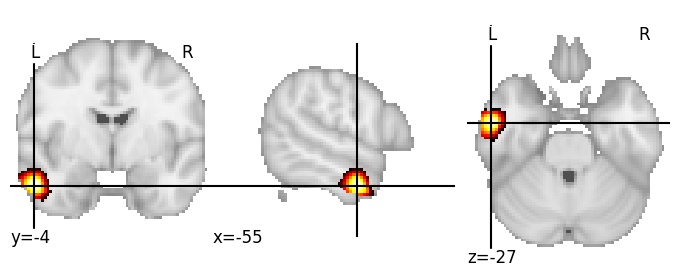 Component 689: Middle temporal gyrus mid-anterior LH
