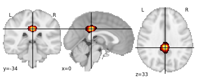 Component 70: Posterior cingulate cortex anterior